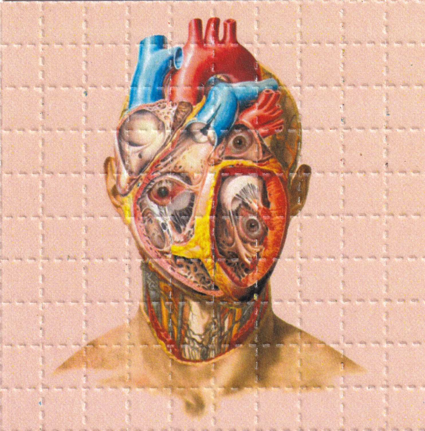Brain Ache LSD Acid Blotter Art By Ziero Muko